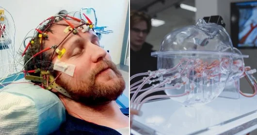 Yuxuda diaqnoz dövrü başlayır: süni intellekt 130 xəstəliyi əvvəlcədən görür