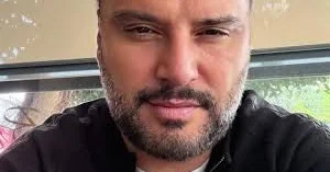 50 yaşında üzünə botoks etdirdi