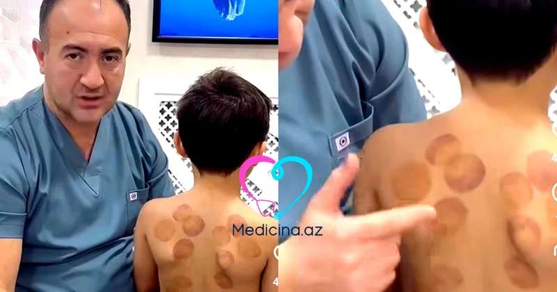 Uşağa neçə yaşında banka qoymaq olar? Düzgün qaydalar VİDEO