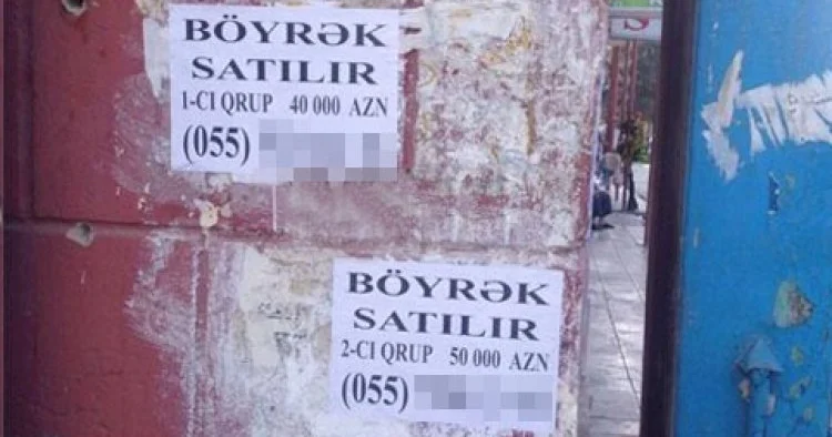 Böyrəyini satmaq istəyən şəxs 6 min manat cərimələndi