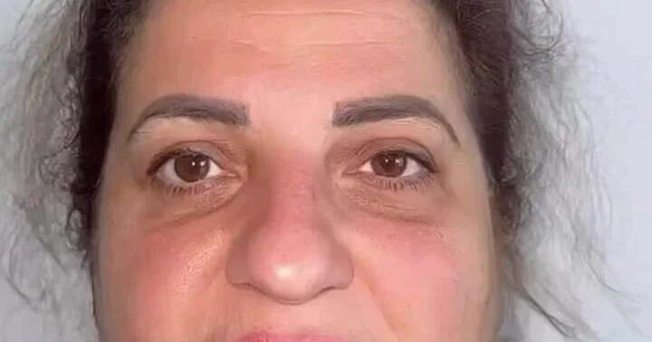 60 yaşlı qadın əməliyyatla 30 yaş CAVANLAŞDI VİDEO