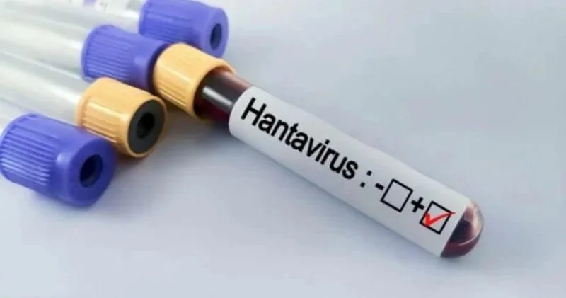 Hantavirus hansı ölkələrdə aşkarlanıb? Yoluxma artır