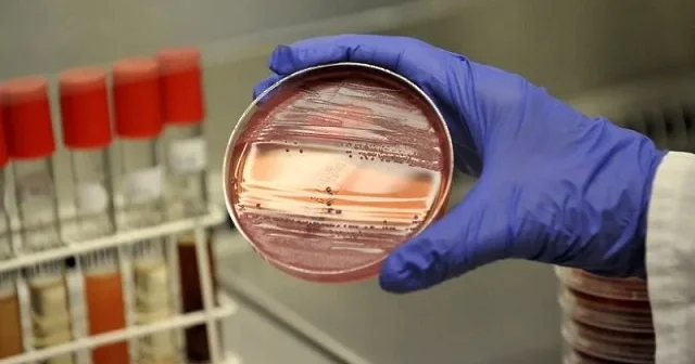 Türkiyədə hantavirus halları varmı? Nazirlikdən ilk açıqlama