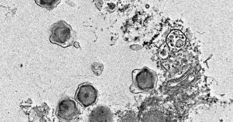 Okeanda tapılan 230 yeni nəhəng virus insan sağlamlığına təsir edə bilər TƏDQİQAT