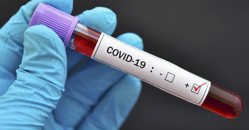 Növbəti koronavirus pandemiyasına yol aça biləcək virus aşkarlanıb