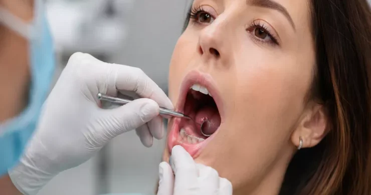 Ağız xərçəngi çox vaxt nəzərə çarpmayan bir əlamətlə başlayır nəyə diqqət yetirmək lazımdır?