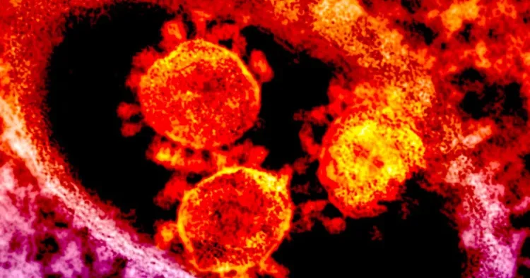 ​​​​​​​ Alimlər ölümcül Nipah və Hendra viruslarına qarşı ilk dəfə effektiv antitellər hazırladılar