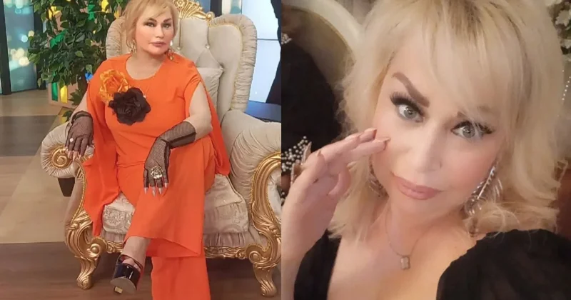 Plastik əməliyyat etdirən müğənninin BAŞINA İŞ GƏLDİ? Əvvəl üzüm bir az başqa cür idi