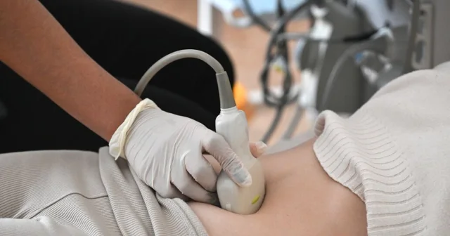 Rusiyada abortdan imtina edənlərin sayı 25 faizə çatıb...