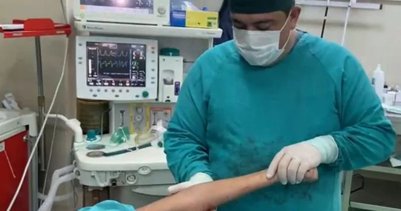 Tik tokda canlı yayımda xəstənin ayağını kəsən cərrahla bağlı araşdırılma başlandı