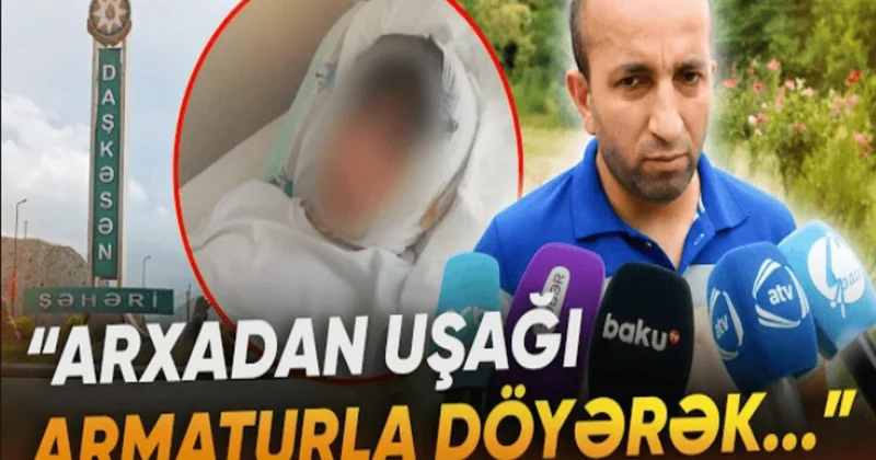 Kənd yolunda mübahisə qanla bitdi: 13 yaşlı yeniyetmə xəstəxanaya yerləşdirildi VİDEO