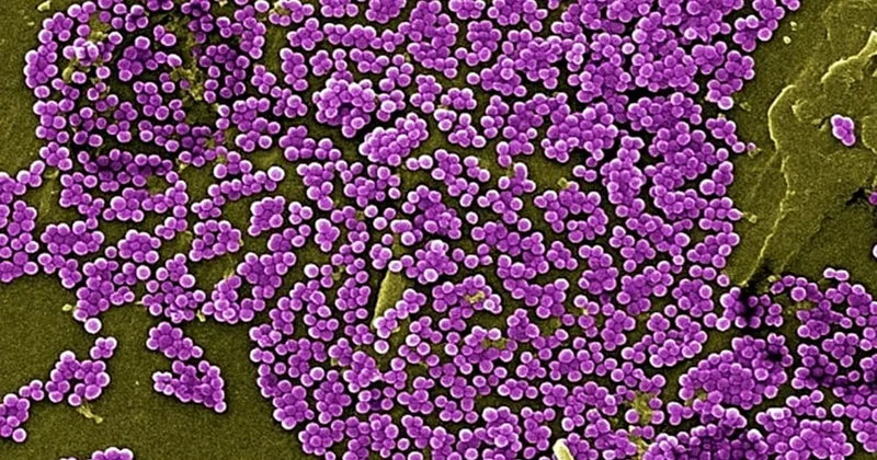 Antibiotiksiz müalicə üsulu tapıldı