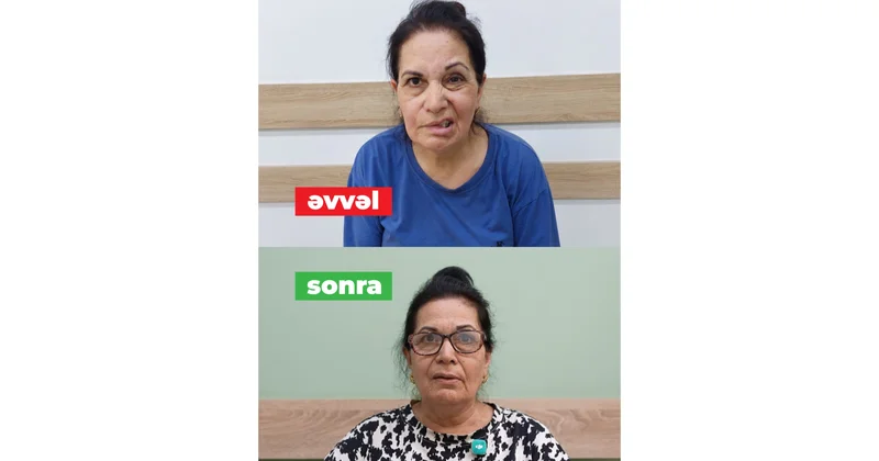 Üz iflicində inteqrativ müalicə: Biotənzimləyici preparatlar vasitəsilə daha sürətli sağalma