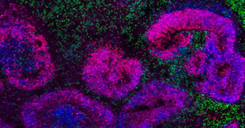 Alimlər ilk beyin atlası tərtib ediblər