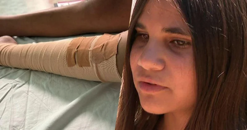 11 летняя девочка пережила укус одной из самых ядовитых змей в мире