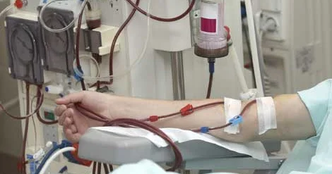 Azərbaycanda 4000 dən çox hemodializ xəstəsi var
