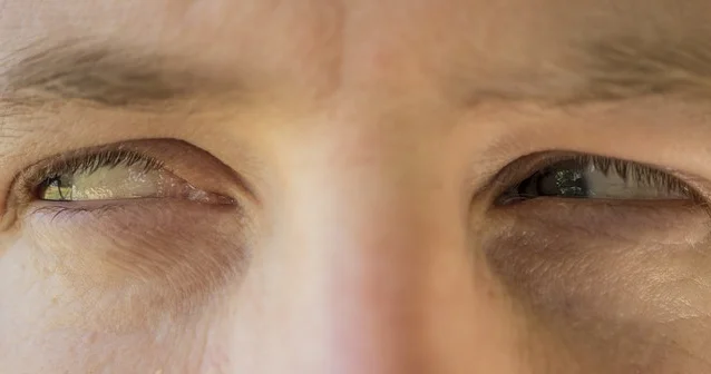 “İnsan həsədindən dolayı kimlərinsə pis aqibətlə üzləşməsini istəyir və fal, cadu kimi işlərə əl atır”