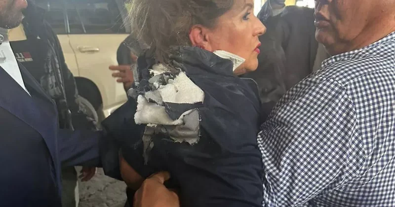 Взрывчатка попала в голову оппозиционного депутата в Гондурасе ФОТО / ВИДЕО