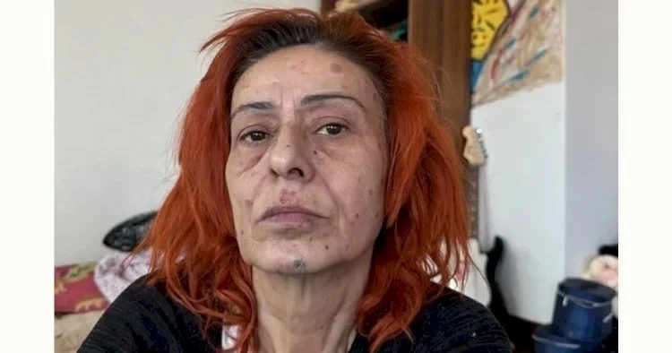 Gözəlliyi ona baha başa gəldi Yıldız Tilbe danışdı KONKRET