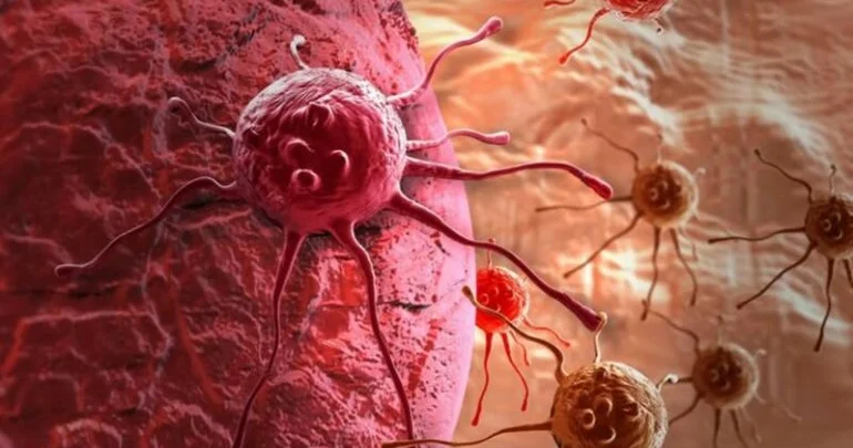 Cəmi 10 dəqiqəlik məşq xərçəngə qarşı qalxan rolunu oynaya bilər