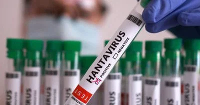 Hantavirus qripə bənzəyir Necə ayırd etməli?