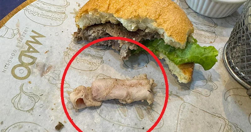 MADO da verilən hamburgerdən görün nə çıxdı Foto