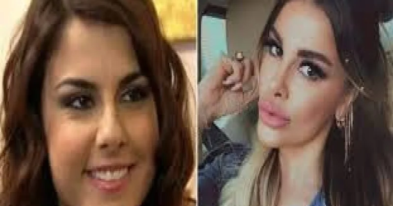 Sevilən aktrisa tanınmaz hala düşdü
