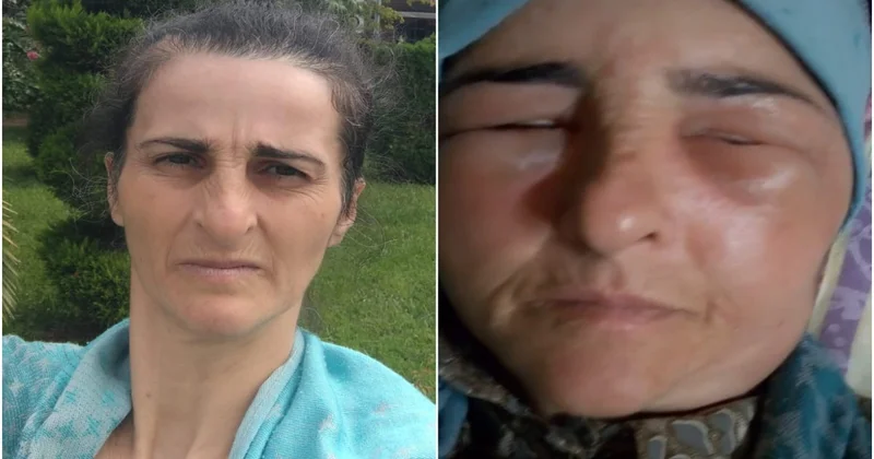​​​​​​​Lənkəranda qonşular arasında dava olub, xəsarət alan var