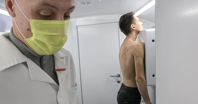 Rusiyada antibiotiklərə davamlı vərəm ştammı aşkar edildi