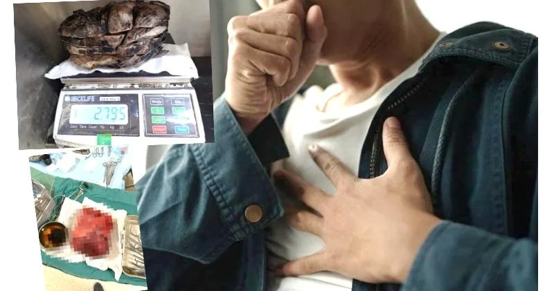 Nəfəs darlığı şikayəti ilə xəstəxanaya getdi