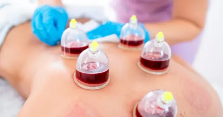 “Hicama yalnız steril və kliniki şəraitdə aparılmalıdır” Həkimdən XƏBƏRDARLIQ
