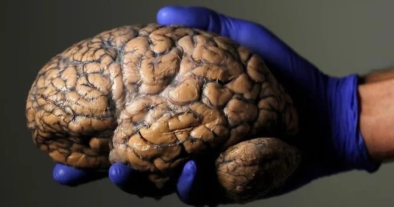 Beyin hüceyrələrinin formalaşması ilk dəfə detallı şəkildə xəritələndi