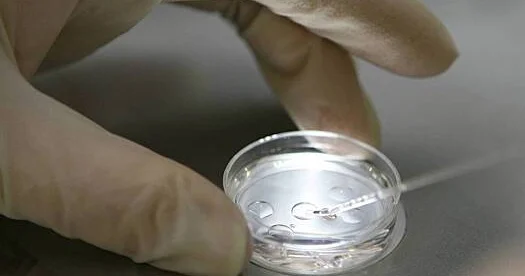 İnsanlar yaşlandıqca insan beyni bəzi yerlərdə genişlənir...