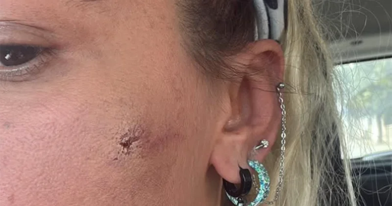 “Ərim məni döyüb” FOTOLAR