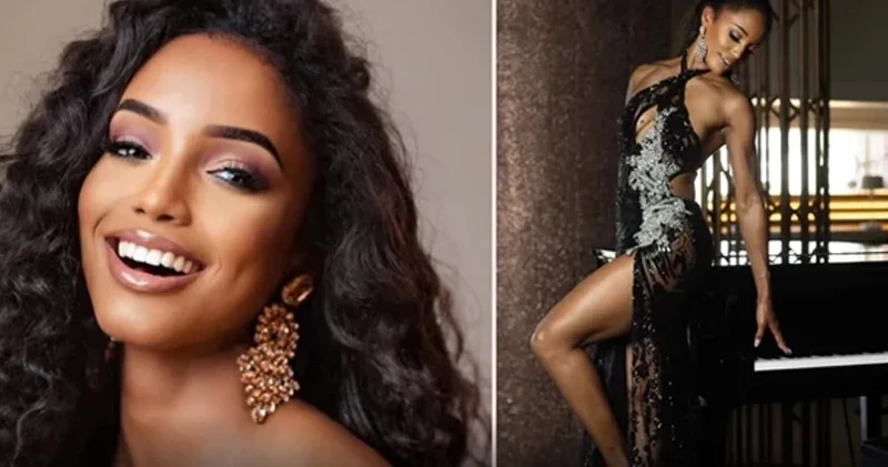 Kainat Gözəli olmaq istəyirdi, həyatı cəhənnəmə döndü 20 gündü reanimasiyadadır