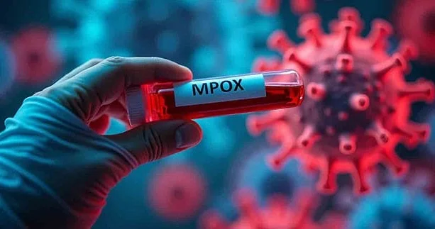 Yeni MPOX ştamı aşkarlandı