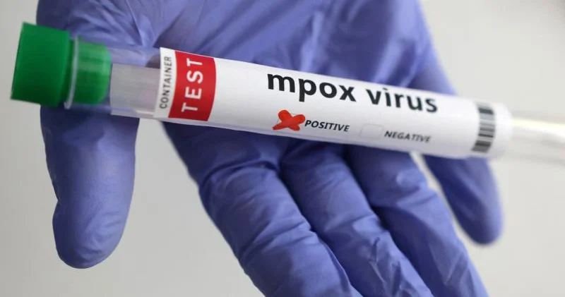 Meymunçiçək virusunun yeni bir ştammı ortaya çıxdı Necə yayılır?