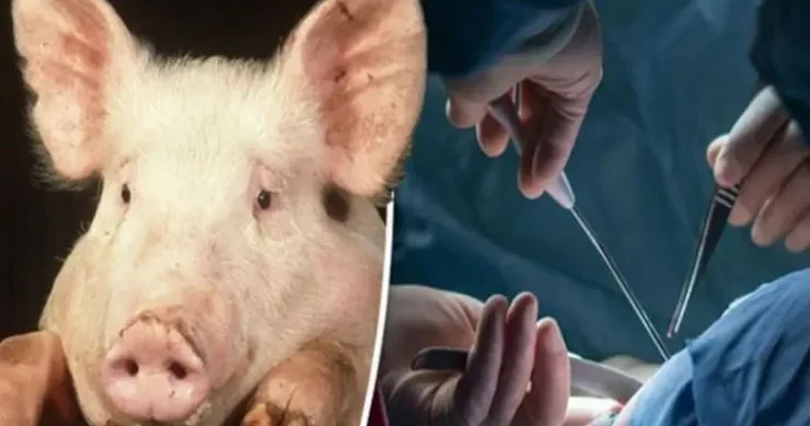 Azərbaycanda insana donuz böyrəyi də köçürüləcək Həkim DANIŞDI