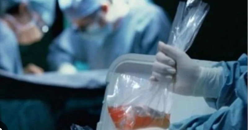 Azərbaycanda orqan transplantasiyası, mövcud vəziyyət və problemlər ARAŞDIRMA