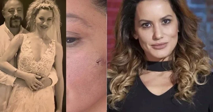 Yıldız Asyalı həyat yoldaşı tərəfindən döyüldüyünü açıqladı Fotolar