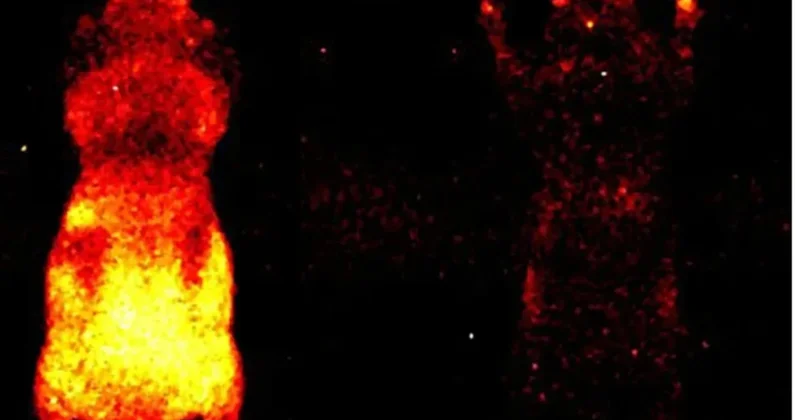 Bədənimiz işıq saçırmış: Elmi təcrübə heyrətləndirdi