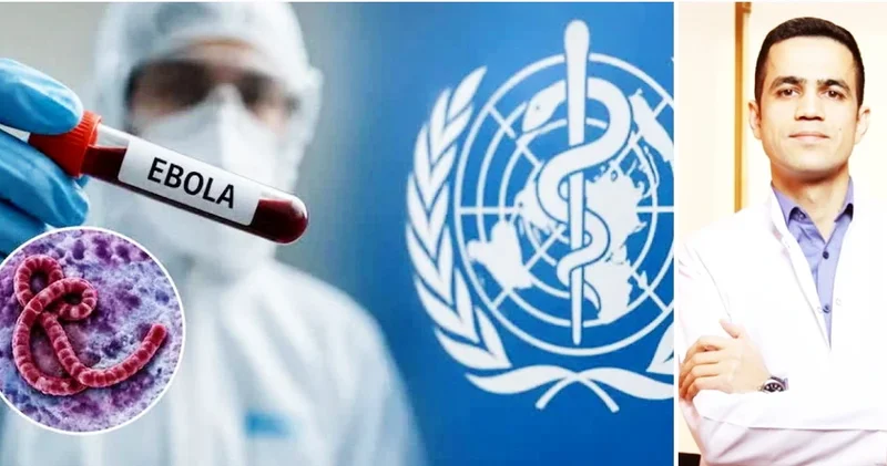 Çiy ət və dəfn mərasimləri: İnfeksionist Ebola ilə bağlı riskləri açıqladı