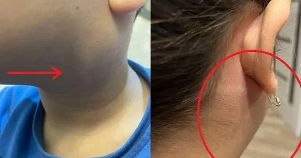 Qulaqdibi də qızılça və suçiçəyi kimi yoluxucu xəstəliklər sırasındadır Professor