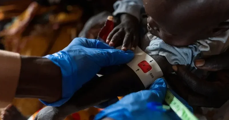 ÜST dən vəba epidemiyası ilə bağlı xəbərdarlıq
