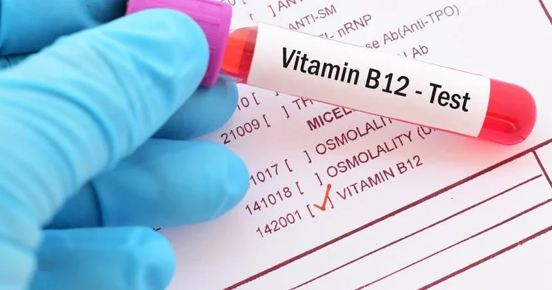 B12 vitamini aşağıdırsa xərçəng riski var Neçə olmalıdır?
