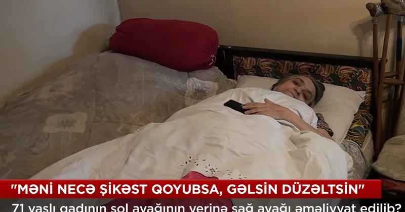 Qadının xəstə ayağı yerinə sağlamı kəsilib? VİDEO