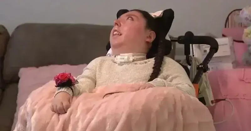 В США женщина без мозга дожила до 20 лет и побила рекорд