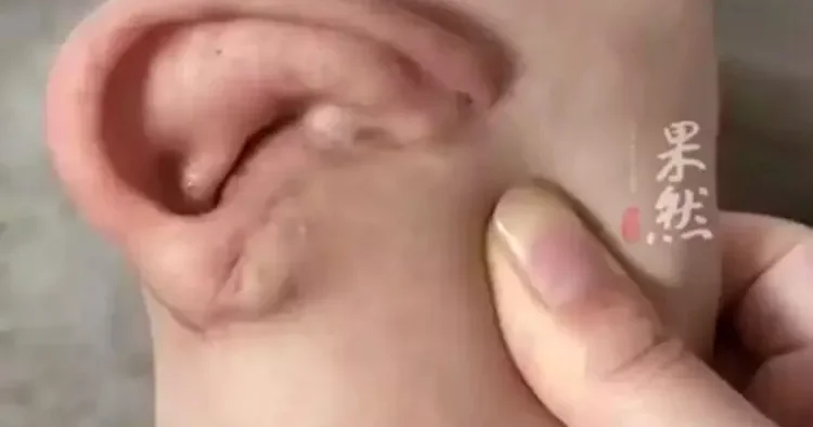 Qopmuş qulağını beş ay ayağında GƏZDİRDİ