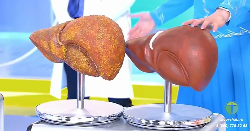 Kimin qaraciyərini araq tez sıradan çıxarır?