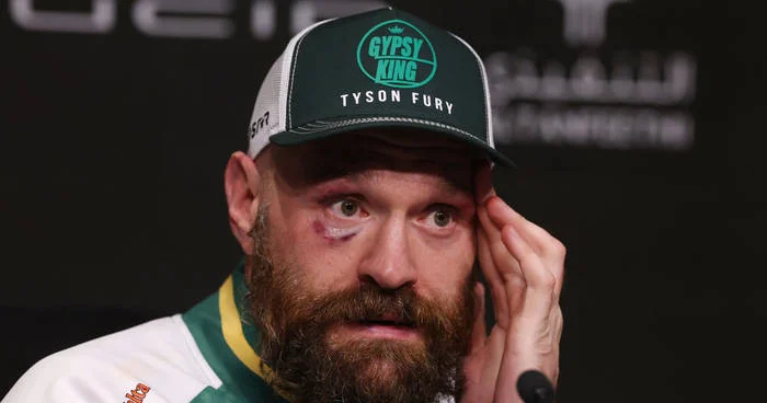 Тайсон Фьюри планирует возобновить карьеру Minval Politika